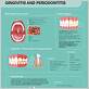 gum disease prevent infographic