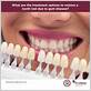 gum disease providence ri