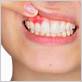 gum disease rocky mount nc