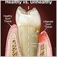 gum disease root pain