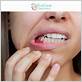 gum disease roswell ga