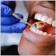 gum disease royal oak