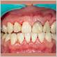 gum disease scottsdale