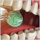 gum disease shreveport la