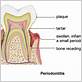 gum disease specialist bournemouth