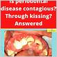 gum disease spread kissing