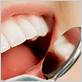 gum disease spring hill