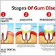 gum disease success stories