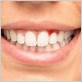 gum disease sutton