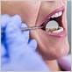 gum disease sw calgary