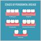 gum disease symptoms stages