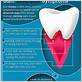 gum disease symtoms