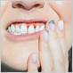gum disease therapy calgary ne