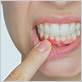 gum disease therapy gloucester