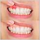 gum disease therapy new york