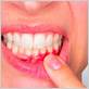 gum disease therapy richmond tx