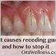 gum disease tingling