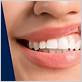 gum disease toronto