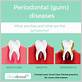 gum disease transferable