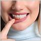 gum disease treatment allen tx