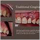 gum disease treatment anchorage