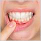 gum disease treatment arlington