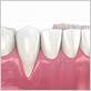 gum disease treatment arlington tx