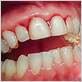 gum disease treatment auburn