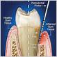 gum disease treatment bangor