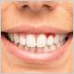 gum disease treatment billerica