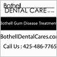 gum disease treatment bothell