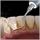 gum disease treatment brookfield il