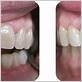 gum disease treatment burr ridge il