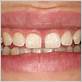 gum disease treatment byfleet