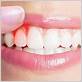 gum disease treatment camp hill