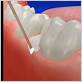 gum disease treatment cherry creek co