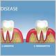 gum disease treatment citrus heights