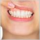 gum disease treatment cleveland tn