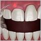 gum disease treatment clovis