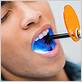 gum disease treatment colorado springs co