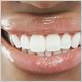 gum disease treatment corona ca