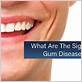 gum disease treatment dawson