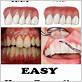 gum disease treatment diy