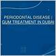 gum disease treatment dubai