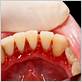 gum disease treatment elizabethtown