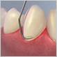 gum disease treatment gilbert az
