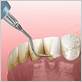 gum disease treatment grand prairie