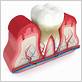 gum disease treatment hinsdale il