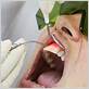 gum disease treatment houston county
