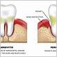 gum disease treatment hybla valley va